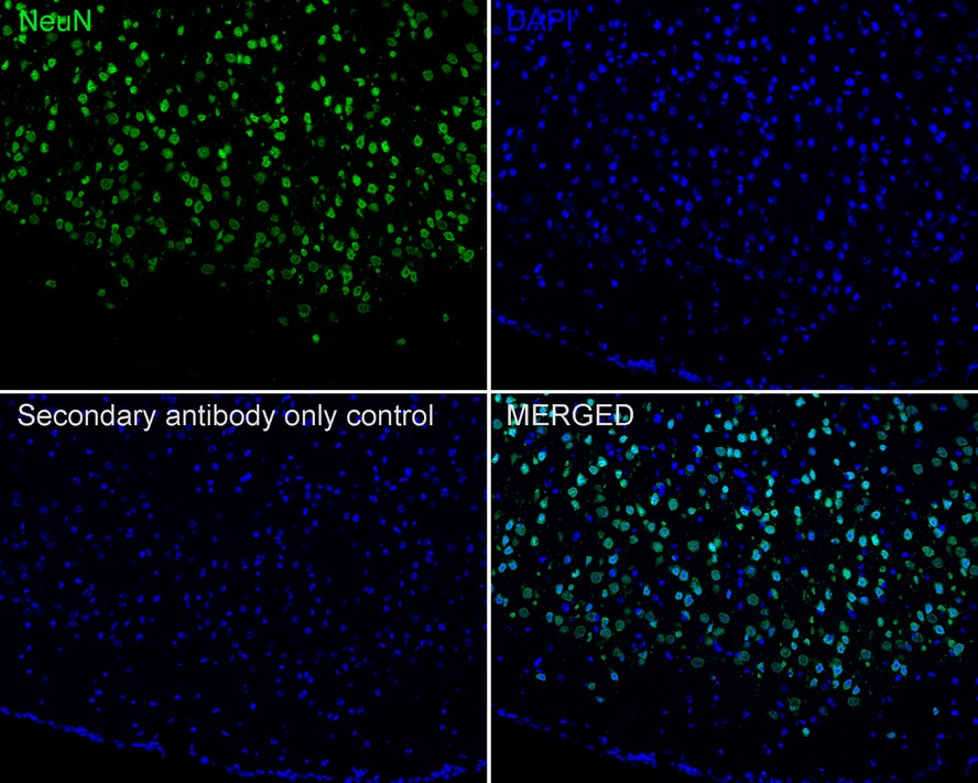 Application: IF-tissue<br /><br />Species: Mouse<br /><br />Site: Cerebral cortex<br /><br />Sample: Paraffin-embedded section<br /><br />Antibody concentration: 1:1,000