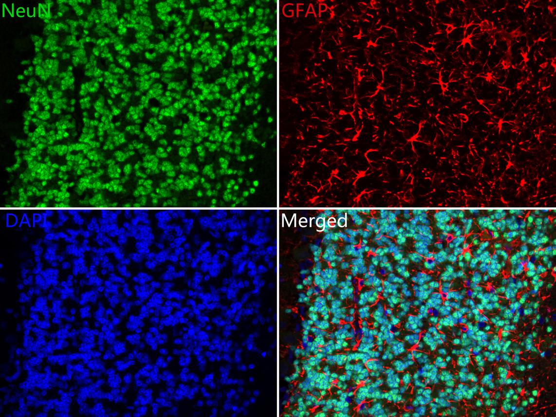 Application: IF-tissue<br /><br />Species: Rat<br /><br />Site: Cerebellum<br /><br />Sample: Paraffin-embedded section<br /><br />Antibody concentration: 1:500 (NeuN, <a href="/products/ET1602-12" style="font-weight: bold;text-decoration: underline;">ET1602-12</a>, green); 1:500 (GFAP, <a href="/products/EM140707" style="font-weight: bold;text-decoration: underline;">EM140707</a>, Red)