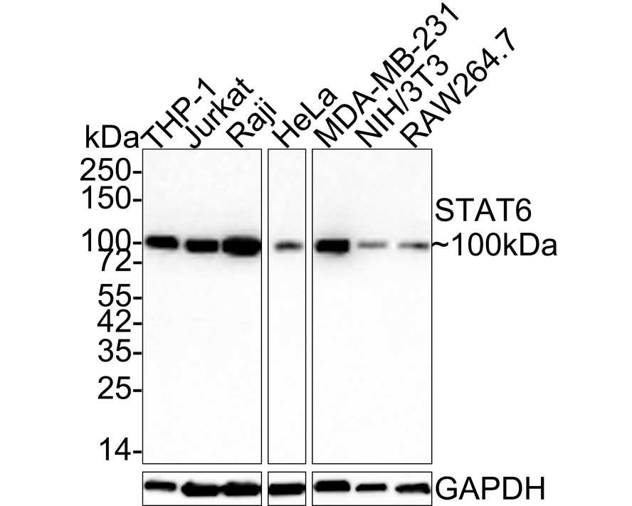 Western blot analysis of STAT6 on different lysates with Rabbit anti-STAT6 antibody (<a href="/products/ET1605-49" style="font-weight: bold;text-decoration: underline;">ET1605-49</a>) at 1/2,000 dilution.<br /><br />Lane 1: THP-1 cell lysate (20 µg/Lane)<br />Lane 2: Jurkat cell lysate (20 µg/Lane)<br />Lane 3: Raji cell lysate (20 µg/Lane)<br />Lane 4: HeLa cell lysate (20 µg/Lane)<br />Lane 5: MDA-MB-231 cell lysate (20 µg/Lane)<br />Lane 6: NIH/3T3 cell lysate (20 µg/Lane)<br />Lane 7: RAW264.7 cell lysate (20 µg/Lane)<br /><br />Predicted band size: 94 kDa<br />Observed band size: 100 kDa<br /><br />Exposure time: 2 minutes;<br />4-20% SDS-PAGE gel.<br /><br />Proteins were transferred to a PVDF membrane and blocked with 5% NFDM/TBST for 1 hour at room temperature. The primary antibody (<a href="/products/ET1605-49" style="font-weight: bold;text-decoration: underline;">ET1605-49</a>) at 1/2,000 dilution was used in 5% NFDM/TBST at room temperature for 2 hours. Goat Anti-Rabbit IgG - HRP Secondary Antibody (<a href="/products/HA1001" style="font-weight: bold;text-decoration: underline;">HA1001</a>) at 1:100,000 dilution was used for 1 hour at room temperature.