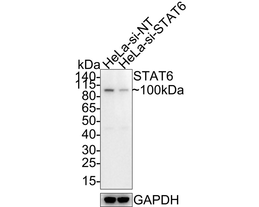 <span style="font-weight: bold;">☑ Knockdown (KD)</span><br /><br />Western blot analysis of STAT6 on different lysates with Rabbit anti-STAT6 antibody (<a href="/products/ET1605-49" style="font-weight: bold;text-decoration: underline;">ET1605-49</a>) at 1/500 dilution.<br /><br />Lane 1: Hela-si NT cell lysate<br />Lane 2: Hela-si STAT6 cell lysate<br /><br />Lysates/proteins at 10 µg/Lane.<br /><br />Predicted band size: 94 kDa<br />Observed band size: 100 kDa<br /><br />Exposure time: 1 minute 34 seconds;<br />4-20% SDS-PAGE gel.<br /><br /><a href="/products/ET1605-49" style="font-weight: bold;text-decoration: underline;">ET1605-49</a> was shown to specifically react with STAT6 in Hela-si NT cells. Weakened band was observed when Hela-si STAT6 sample was tested. Hela-si NT and Hela-si STAT6 samples were subjected to SDS-PAGE. Proteins were transferred to a PVDF membrane and blocked with 5% NFDM in TBST for 1 hour at room temperature. The primary antibody (<a href="/products/ET1605-49" style="font-weight: bold;text-decoration: underline;">ET1605-49</a>, 1/500) and Loading control antibody (Rabbit anti-GAPDH, <a href="/products/ET1601-4" style="font-weight: bold;text-decoration: underline;">ET1601-4</a>, 1/10,000) were used in 5% BSA at room temperature for 2 hours. Goat Anti-rabbit IgG-HRP Secondary Antibody (<a href="/products/HA1001" style="font-weight: bold;text-decoration: underline;">HA1001</a>) at 1:300,000 dilution was used for 1 hour at room temperature.