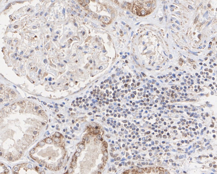 Immunohistochemical analysis of paraffin-embedded human kidney tissue with Rabbit anti-STAT6 antibody (<a href="/products/ET1605-49" style="font-weight: bold;text-decoration: underline;">ET1605-49</a>) at 1/3,000 dilution.<br /><br />The section was pre-treated using heat mediated antigen retrieval with sodium citrate buffer (pH 6.0) for 2 minutes. The tissues were blocked in 1% BSA for 20 minutes at room temperature, washed with ddH<sub>2</sub>O and PBS, and then probed with the primary antibody (<a href="/products/ET1605-49" style="font-weight: bold;text-decoration: underline;">ET1605-49</a>) at 1/3,000 dilution for 1 hour at room temperature. The detection was performed using an HRP conjugated compact polymer system. DAB was used as the chromogen. Tissues were counterstained with hematoxylin and mounted with DPX.