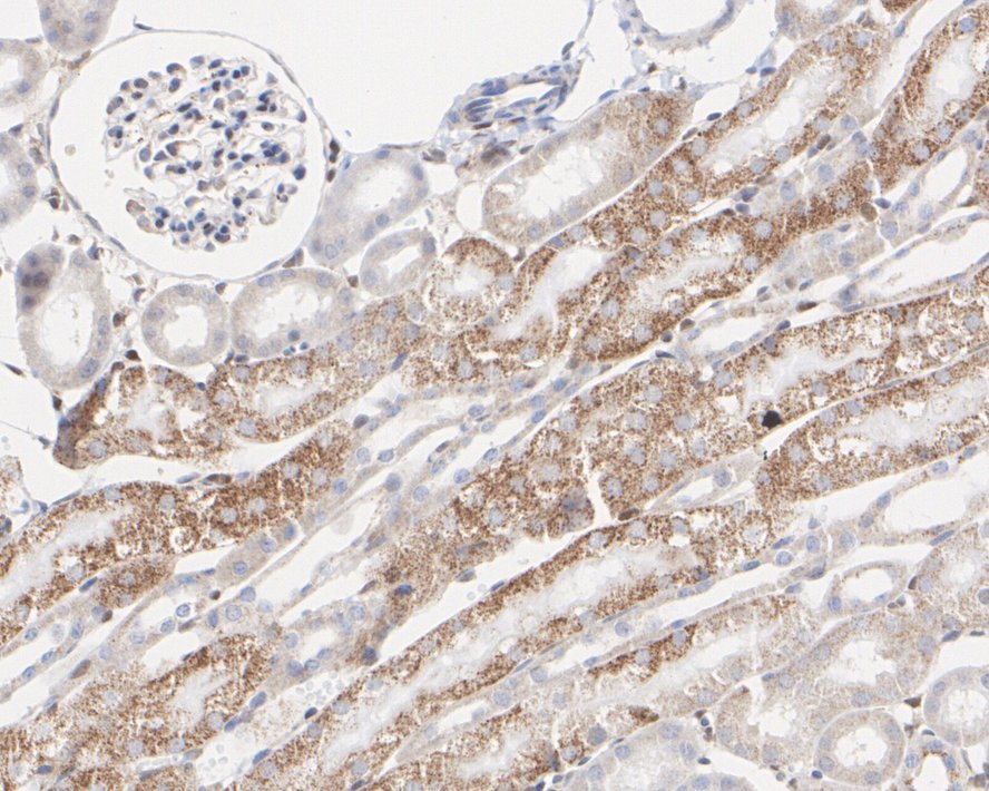 Immunohistochemical analysis of paraffin-embedded mouse kidney tissue with Rabbit anti-STAT6 antibody (<a href="/products/ET1605-49" style="font-weight: bold;text-decoration: underline;">ET1605-49</a>) at 1/3,000 dilution.<br /><br />The section was pre-treated using heat mediated antigen retrieval with sodium citrate buffer (pH 6.0) for 2 minutes. The tissues were blocked in 1% BSA for 20 minutes at room temperature, washed with ddH<sub>2</sub>O and PBS, and then probed with the primary antibody (<a href="/products/ET1605-49" style="font-weight: bold;text-decoration: underline;">ET1605-49</a>) at 1/3,000 dilution for 1 hour at room temperature. The detection was performed using an HRP conjugated compact polymer system. DAB was used as the chromogen. Tissues were counterstained with hematoxylin and mounted with DPX.