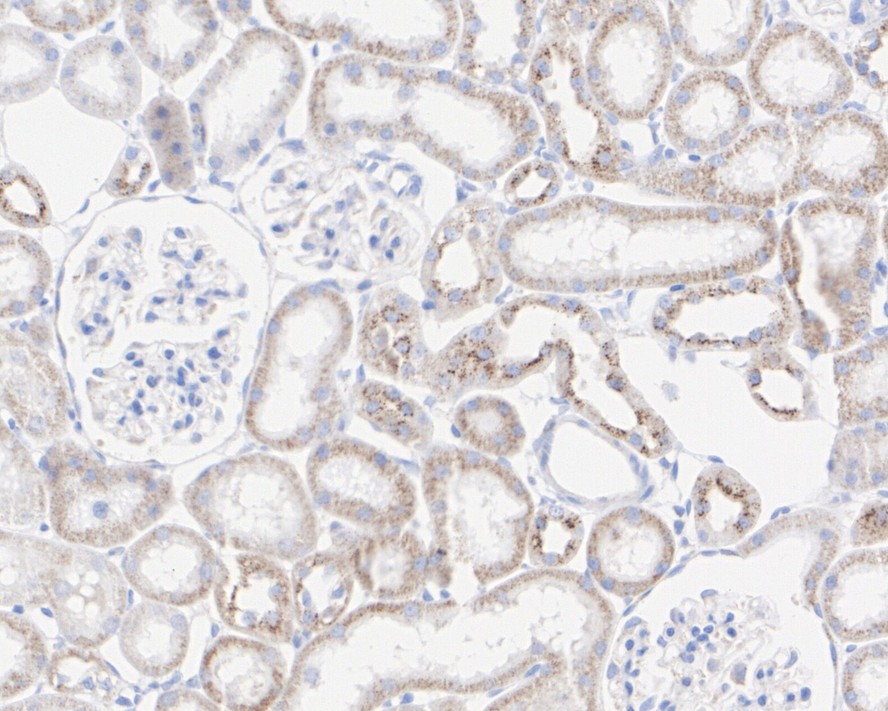 Immunohistochemical analysis of paraffin-embedded rat kidney tissue with Rabbit anti-STAT6 antibody (<a href="/products/ET1605-49" style="font-weight: bold;text-decoration: underline;">ET1605-49</a>) at 1/3,000 dilution.<br /><br />The section was pre-treated using heat mediated antigen retrieval with sodium citrate buffer (pH 6.0) for 2 minutes. The tissues were blocked in 1% BSA for 20 minutes at room temperature, washed with ddH<sub>2</sub>O and PBS, and then probed with the primary antibody (<a href="/products/ET1605-49" style="font-weight: bold;text-decoration: underline;">ET1605-49</a>) at 1/3,000 dilution for 1 hour at room temperature. The detection was performed using an HRP conjugated compact polymer system. DAB was used as the chromogen. Tissues were counterstained with hematoxylin and mounted with DPX.