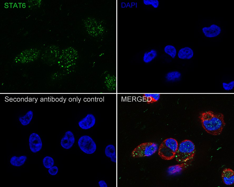 Immunocytochemistry analysis of MDA-MB-231 cells labeling STAT6 with Rabbit anti-STAT6 antibody (<a href="/products/ET1605-49" style="font-weight: bold;text-decoration: underline;">ET1605-49</a>) at 1/500 dilution.<br /><br />Cells were fixed in 4% paraformaldehyde for 20 minutes at room temperature, permeabilized with 0.1% Triton X-100 in PBS for 5 minutes at room temperature, then blocked with 1% BSA in 10% negative goat serum for 1 hour at room temperature. Cells were then incubated with Rabbit anti-STAT6 antibody (<a href="/products/ET1605-49" style="font-weight: bold;text-decoration: underline;">ET1605-49</a>) at 1/500 dilution in 1% BSA in PBST overnight at 4 ℃. Goat Anti-Rabbit IgG H&L (iFluor™ 488, <a href="/products/HA1121" style="font-weight: bold;text-decoration: underline;">HA1121</a>) was used as the secondary antibody at 1/1,000 dilution. PBS instead of the primary antibody was used as the secondary antibody only control. Nuclear DNA was labelled in blue with DAPI.<br /><br />Beta tubulin (<a href="/products/M1305-2" style="font-weight: bold;text-decoration: underline;">M1305-2</a>, red) was stained at 1/100 dilution overnight at +4℃. Goat Anti-Mouse IgG H&L (iFluor™ 594, <a href="/products/HA1126" style="font-weight: bold;text-decoration: underline;">HA1126</a>) was used as the secondary antibody at 1/1,000 dilution.