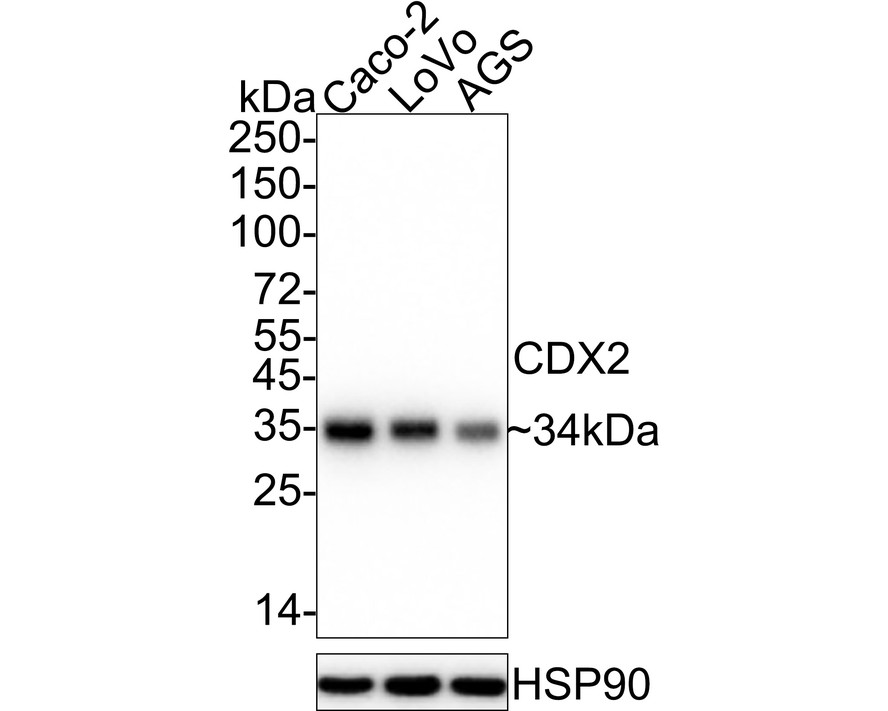 Western blot analysis of CDX2 on different lysates with Rabbit anti-CDX2 antibody (<a href="/products/ET1605-4" style="font-weight: bold;text-decoration: underline;">ET1605-4</a>) at 1/1,000 dilution.<br /><br />Lane 1: Caco-2 cell lysate<br />Lane 2: LoVo cell lysate<br />Lane 3: AGS cell lysate<br /><br />Lysates/proteins at 15 µg/Lane.<br /><br />Predicted band size: 34 kDa<br />Observed band size: 34 kDa<br /><br />Exposure time: 25 seconds; ECL: K1801;<br /><br />4-20% SDS-PAGE gel.<br /><br />Proteins were transferred to a PVDF membrane and blocked with 5% NFDM/TBST for 1 hour at room temperature. The primary antibody (<a href="/products/ET1605-4" style="font-weight: bold;text-decoration: underline;">ET1605-4</a>) at 1/1,000 dilution was used in 5% NFDM/TBST at 4℃ overnight. Goat Anti-Rabbit IgG - HRP Secondary Antibody (<a href="/products/HA1001" style="font-weight: bold;text-decoration: underline;">HA1001</a>) at 1/50,000 dilution was used for 1 hour at room temperature.