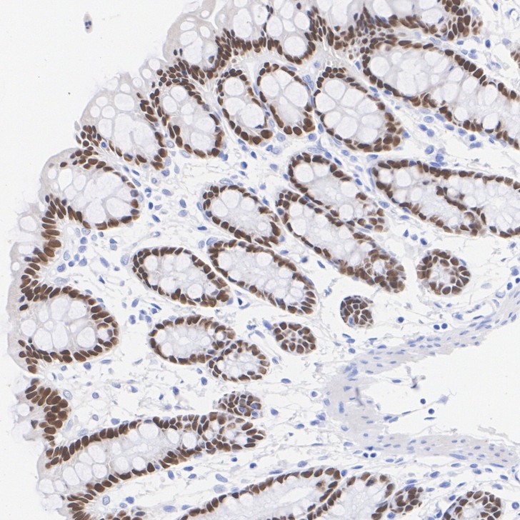 Immunohistochemical analysis of paraffin-embedded rat colon tissue with Rabbit anti-CDX2 antibody (<a href="/products/ET1605-4" style="font-weight: bold;text-decoration: underline;">ET1605-4</a>) at 1/20,000 dilution.<br /><br />The section was pre-treated using heat mediated antigen retrieval with sodium citrate buffer (pH 6.0) for 2 minutes. The tissues were blocked in 1% BSA for 20 minutes at room temperature, washed with ddH<sub>2</sub>O and PBS, and then probed with the primary antibody (<a href="/products/ET1605-4" style="font-weight: bold;text-decoration: underline;">ET1605-4</a>) at 1/20,000 dilution for 1 hour at room temperature. The detection was performed using an HRP conjugated compact polymer system. DAB was used as the chromogen. Tissues were counterstained with hematoxylin and mounted with DPX.