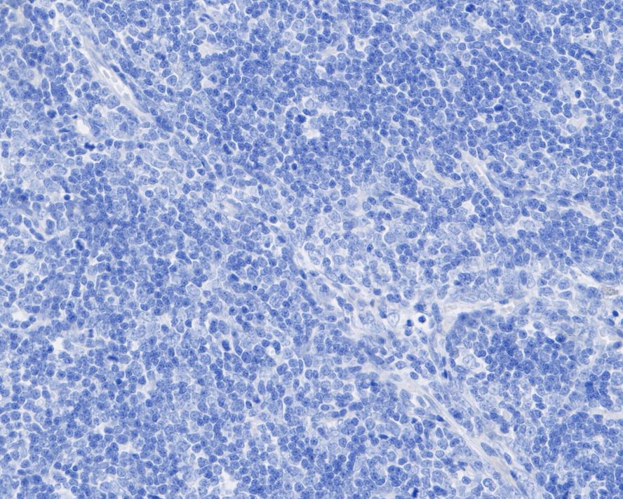 <span style="font-weight: bold;">☑ Relative expression (RE)</span><br /><br />Immunohistochemical analysis of paraffin-embedded human thymus tissue (negative) with Rabbit anti-CDX2 antibody (<a href="/products/ET1605-4" style="font-weight: bold;text-decoration: underline;">ET1605-4</a>) at 1/5,000 dilution.<br /><br />The section was pre-treated using heat mediated antigen retrieval with sodium citrate buffer (pH 6.0) for 2 minutes. The tissues were blocked in 1% BSA for 20 minutes at room temperature, washed with ddH<sub>2</sub>O and PBS, and then probed with the primary antibody (<a href="/products/ET1605-4" style="font-weight: bold;text-decoration: underline;">ET1605-4</a>) at 1/5,000 dilution for 1 hour at room temperature. The detection was performed using an HRP conjugated compact polymer system. DAB was used as the chromogen. Tissues were counterstained with hematoxylin and mounted with DPX.