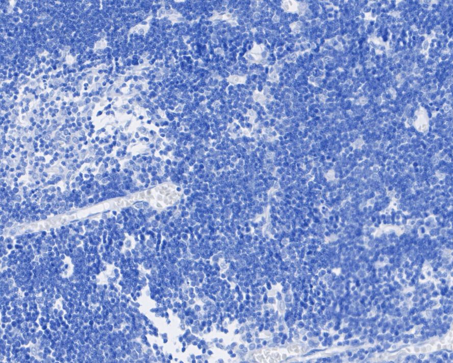 <span style="font-weight: bold;">☑ Relative expression (RE)</span><br /><br />Immunohistochemical analysis of paraffin-embedded rat thymus tissue (negative) with Rabbit anti-CDX2 antibody (<a href="/products/ET1605-4" style="font-weight: bold;text-decoration: underline;">ET1605-4</a>) at 1/5,000 dilution.<br /><br />The section was pre-treated using heat mediated antigen retrieval with sodium citrate buffer (pH 6.0) for 2 minutes. The tissues were blocked in 1% BSA for 20 minutes at room temperature, washed with ddH<sub>2</sub>O and PBS, and then probed with the primary antibody (<a href="/products/ET1605-4" style="font-weight: bold;text-decoration: underline;">ET1605-4</a>) at 1/5,000 dilution for 1 hour at room temperature. The detection was performed using an HRP conjugated compact polymer system. DAB was used as the chromogen. Tissues were counterstained with hematoxylin and mounted with DPX.