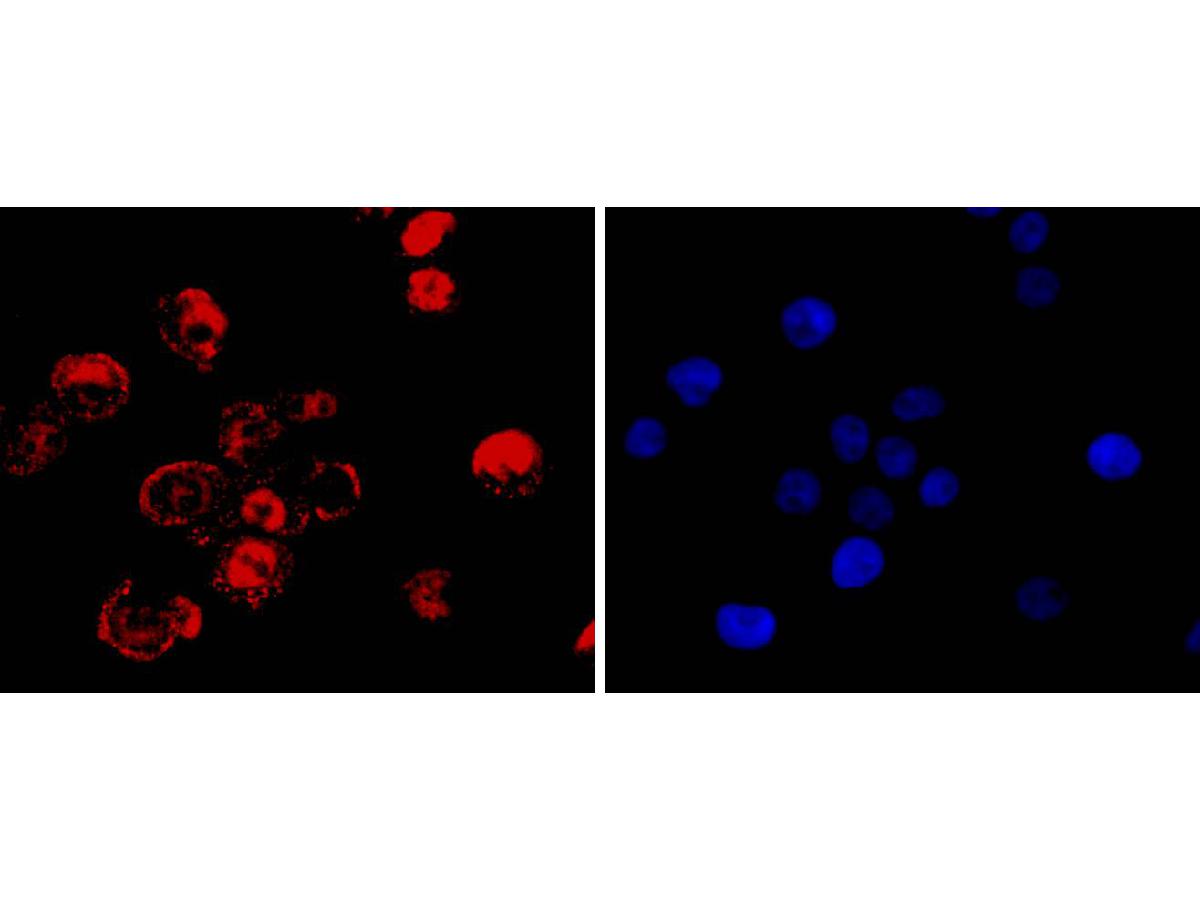 ICC staining of CDX2 in LOVO cells (red). Formalin fixed cells were permeabilized with 0.1% Triton X-100 in TBS for 10 minutes at room temperature and blocked with 1% Blocker BSA for 15 minutes at room temperature. Cells were probed with the primary antibody (<a href="/products/ET1605-4" style="font-weight: bold;text-decoration: underline;">ET1605-4</a>, 1/50) for 1 hour at room temperature, washed with PBS. Alexa Fluor®488 Goat anti-Rabbit IgG was used as the secondary antibody at 1/1,000 dilution. The nuclear counter stain is DAPI (blue).