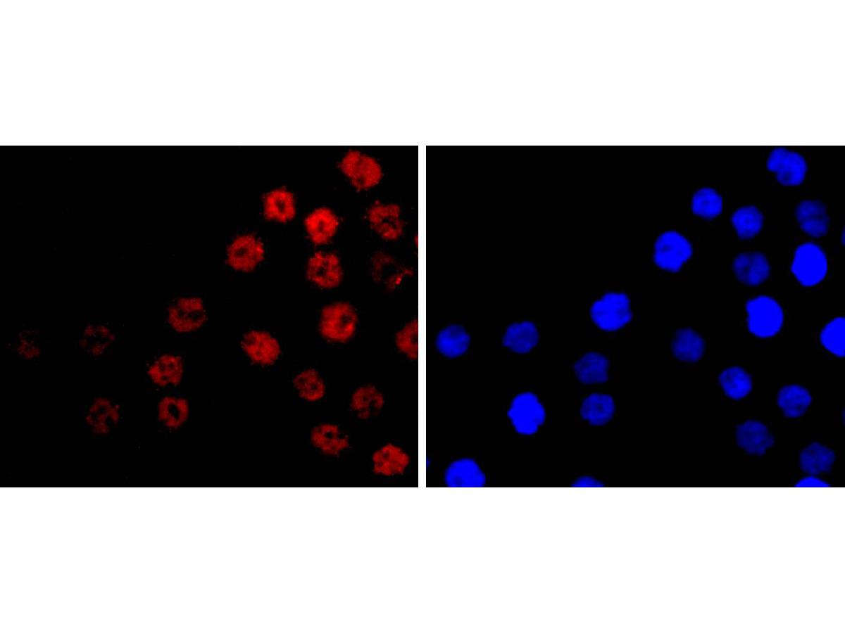 ICC staining of CDX2 in AGS cells (red). Formalin fixed cells were permeabilized with 0.1% Triton X-100 in TBS for 10 minutes at room temperature and blocked with 1% Blocker BSA for 15 minutes at room temperature. Cells were probed with the primary antibody (<a href="/products/ET1605-4" style="font-weight: bold;text-decoration: underline;">ET1605-4</a>, 1/50) for 1 hour at room temperature, washed with PBS. Alexa Fluor®488 Goat anti-Rabbit IgG was used as the secondary antibody at 1/1,000 dilution. The nuclear counter stain is DAPI (blue).