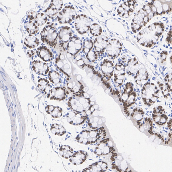 Immunohistochemical analysis of paraffin-embedded mouse colon tissue with Rabbit anti-CDX2 antibody (<a href="/products/ET1605-4" style="font-weight: bold;text-decoration: underline;">ET1605-4</a>) at 1/20,000 dilution.<br /><br />The section was pre-treated using heat mediated antigen retrieval with sodium citrate buffer (pH 6.0) for 2 minutes. The tissues were blocked in 1% BSA for 20 minutes at room temperature, washed with ddH<sub>2</sub>O and PBS, and then probed with the primary antibody (<a href="/products/ET1605-4" style="font-weight: bold;text-decoration: underline;">ET1605-4</a>) at 1/20,000 dilution for 1 hour at room temperature. The detection was performed using an HRP conjugated compact polymer system. DAB was used as the chromogen. Tissues were counterstained with hematoxylin and mounted with DPX.