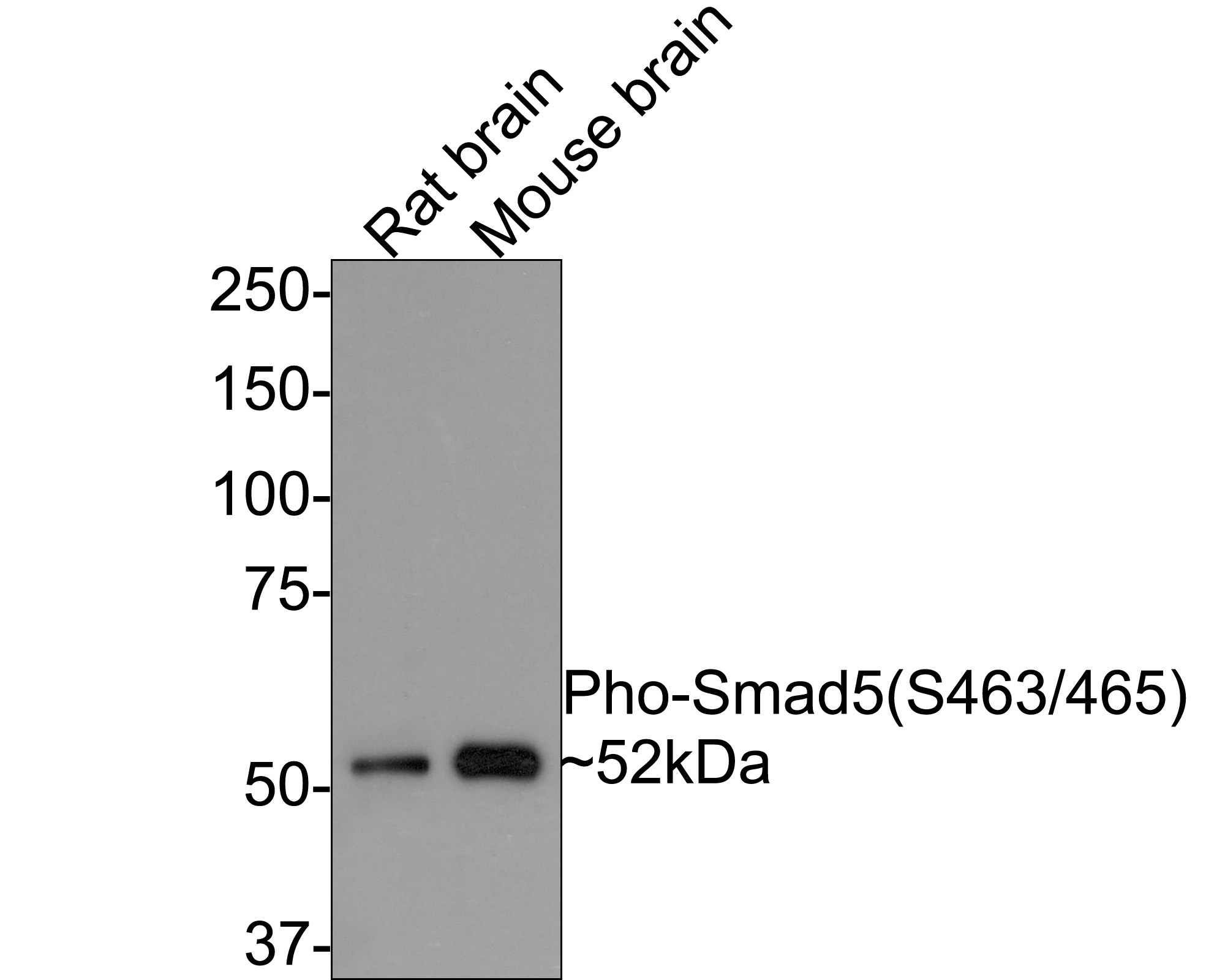Phospho-SMAD5 (Ser463/Ser465) (P16) Rabbit mAb main image 1