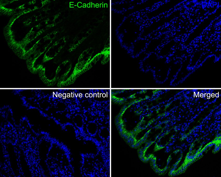 Application: IF-tissue<br /><br />Species: Human <br /><br />Site: Colon<br /><br />Sample: Paraffin-embedded section<br /><br />Antibody concentration: 1/200