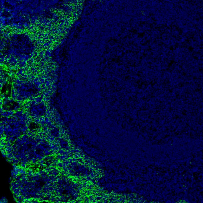 mIHC analysis of human tonsils tissue (Formalin/PFA-fixed paraffin-embedded sections) with Rabbit anti-E-Cadherin antibody (<a href=