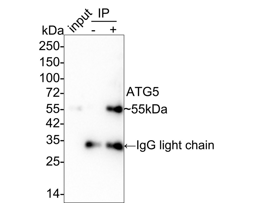 ATG5 was immunoprecipitated in 0.2mg HeLa cell lysate with <a href=