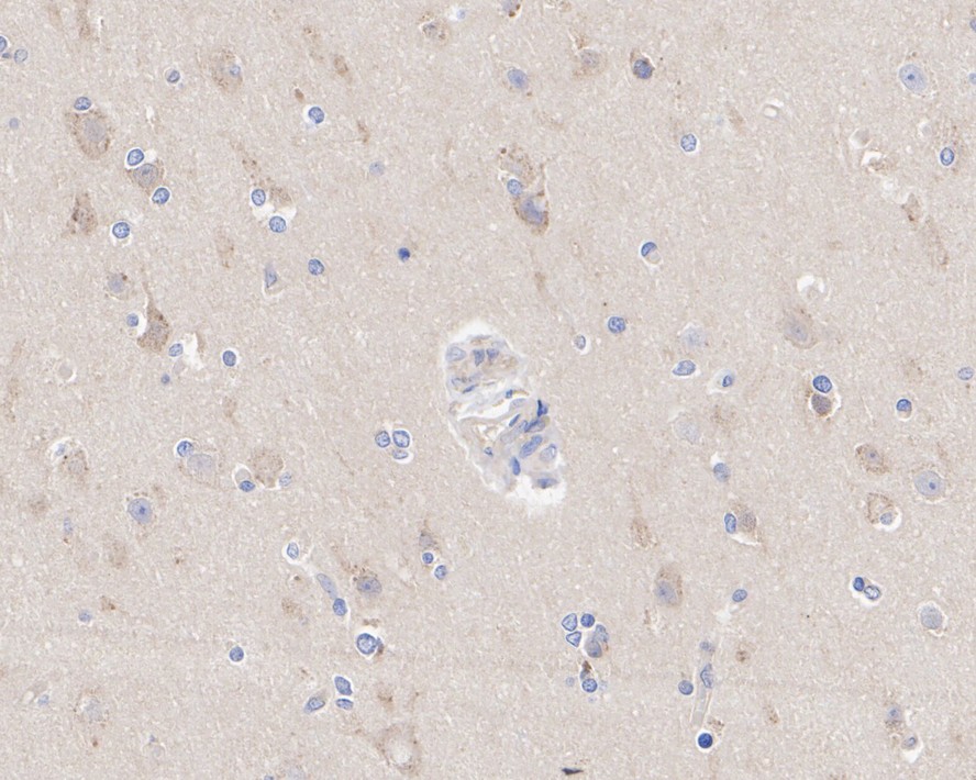 Immunohistochemical analysis of paraffin-embedded human brain tissue with Rabbit anti-ATG5 antibody (<a href=