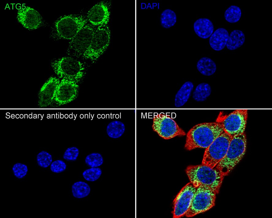 Immunocytochemistry analysis of NIH/3T3 cells labeling ATG5 with Rabbit anti-ATG5 antibody (<a href=