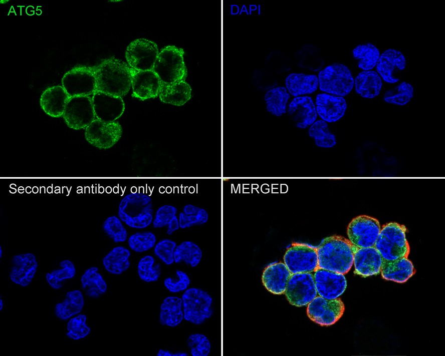 Immunocytochemistry analysis of PC-12 cells labeling ATG5 with Rabbit anti-ATG5 antibody (<a href=