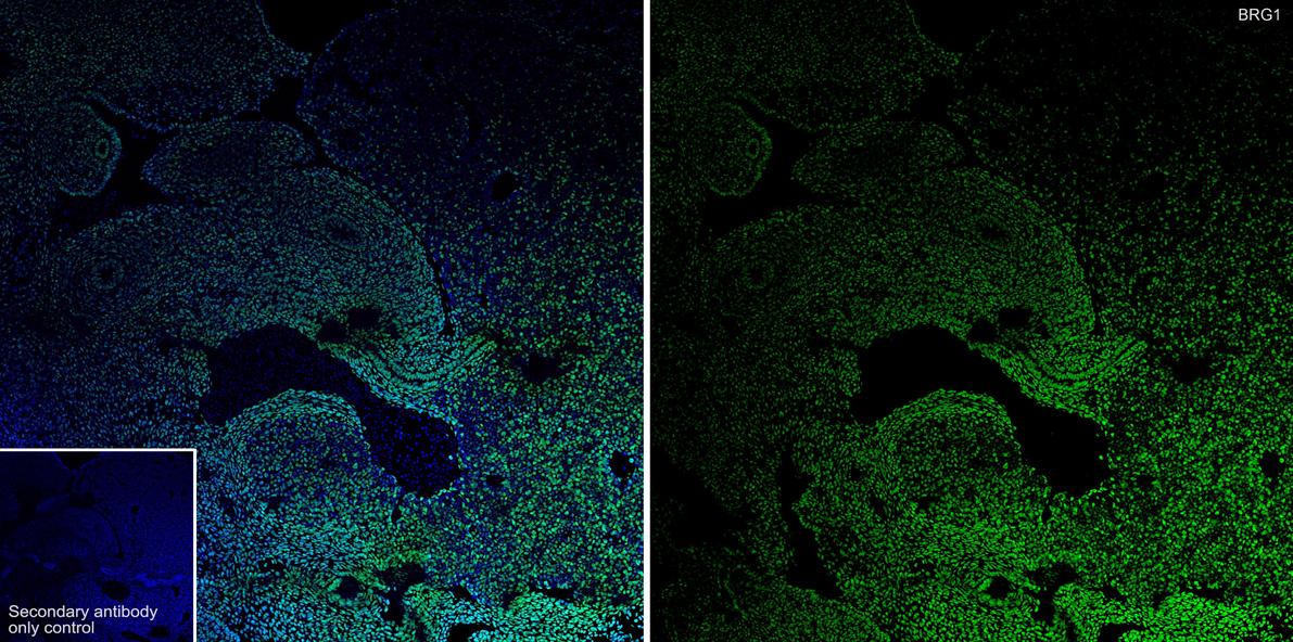 Application: IHC-Fr<br /><br />Species: Mouse<br /><br />Site: E14.5 embryo<br /><br />Sample: Frozen section<br /><br />Antibody concentration: 1:1,000<br /><br />Antigen retrieval: Not required