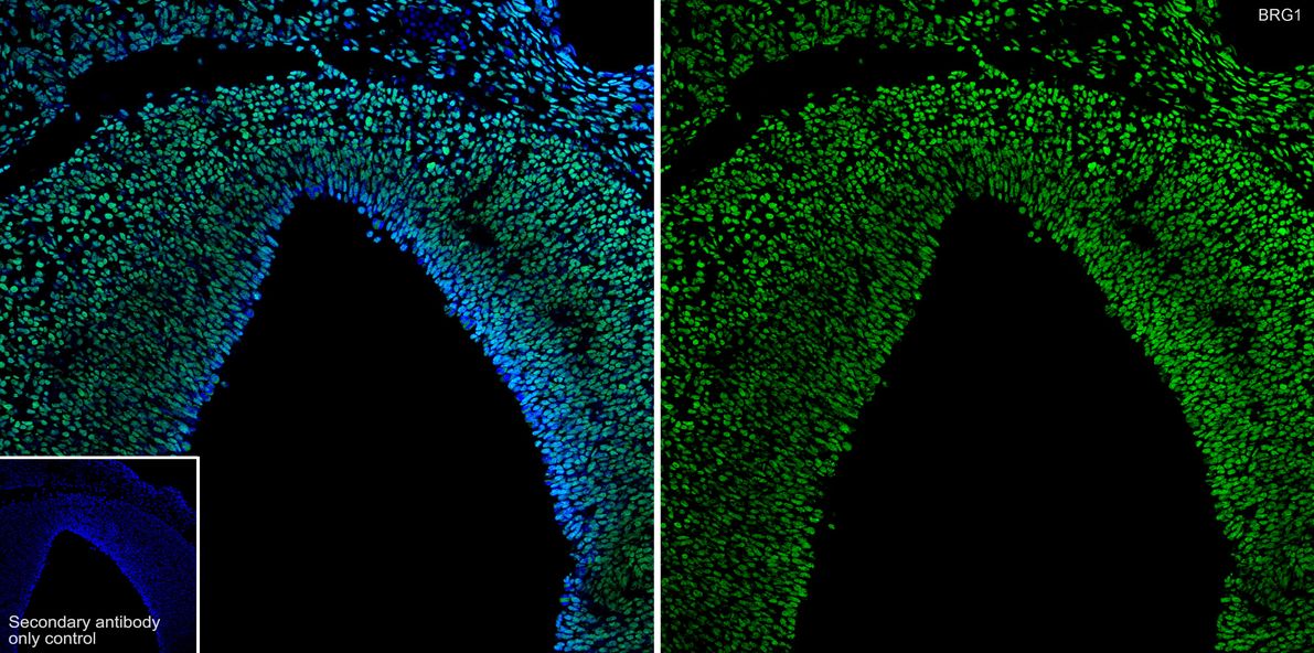 Application: IHC-Fr<br /><br />Species: Mouse<br /><br />Site: E14.5 embryo<br /><br />Sample: Frozen section<br /><br />Antibody concentration: 1:1,000<br /><br />Antigen retrieval: The section was pre-treated using heat mediated antigen retrieval with sodium citrate buffer (pH 6.0) for about 2 minutes in microwave oven.