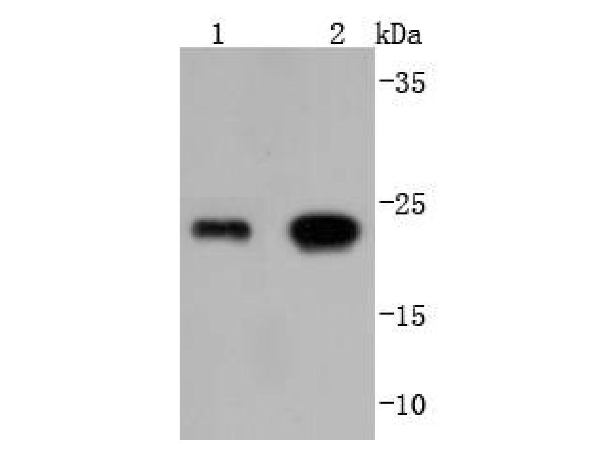 glutathione peroxidase monoclonal antibody Anti-GPX1/Glutathione 1 Rabbit Suitable for IHC Glutathione Peroxidase 1 Recombinant Rabbit