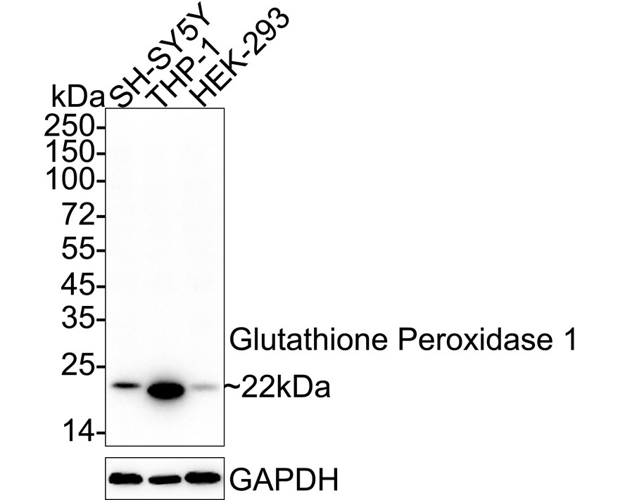glutathione peroxidase 3 antibody 3/GPX3 Rat samples. Promote the development of life