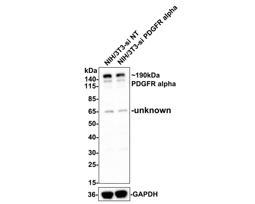 <span style="font-weight: bold;">☑ Knockdown (KD)</span><br /><br />Western blot analysis of PDGFR alpha on different lysates with Rabbit anti-PDGFR alpha antibody (<a href="/products/ET1702-49" style="font-weight: bold;text-decoration: underline;">ET1702-49</a>) at 1/5,000 dilution.<br /><br />Lane 1: NIH/3T3-si NT cell lysate<br />Lane 2: NIH/3T3-si PDGFR alpha cell lysate<br /><br />Lysates/proteins at 10 µg/Lane.<br /><br />Predicted band size: 123 kDa<br />Observed band size: 190 kDa<br /><br />Exposure time: 2 minutes;<br /><br />4-20% SDS-PAGE gel.<br /><br />Proteins were transferred to a PVDF membrane and blocked with 5% NFDM in TBST for 1 hour at room temperature. The primary antibody (<a href="/products/ET1702-49" style="font-weight: bold;text-decoration: underline;">ET1702-49</a>, 1/5,000) and Loading control antibody (Rabbit anti-GAPDH, <a href="/products/ET1601-4" style="font-weight: bold;text-decoration: underline;">ET1601-4</a>, 1/10,000) were used in 5% BSA at room temperature for 2 hours. Goat Anti-rabbit IgG-HRP Secondary Antibody (<a href="/products/HA1001" style="font-weight: bold;text-decoration: underline;">HA1001</a>) at 1/50,000 dilution was used for 1 hour at room temperature.
