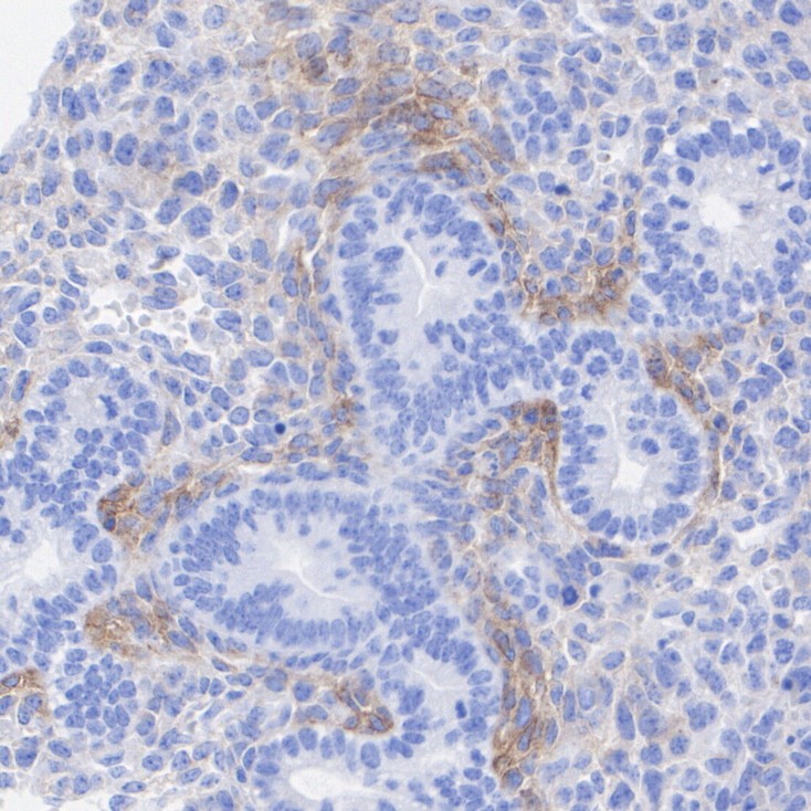 Immunohistochemical analysis of paraffin-embedded mouse embryonic lung tissue with Rabbit anti-PDGFR alpha antibody (<a href="/products/ET1702-49" style="font-weight: bold;text-decoration: underline;">ET1702-49</a>) at 1/2,000 dilution.<br /><br />The section was pre-treated using heat mediated antigen retrieval with Tris-EDTA buffer (pH 9.0) for 20 minutes. The tissues were blocked in 1% BSA for 20 minutes at room temperature, washed with ddH<sub>2</sub>O and PBS, and then probed with the primary antibody (<a href="/products/ET1702-49" style="font-weight: bold;text-decoration: underline;">ET1702-49</a>) at 1/2,000 dilution for 1 hour at room temperature. The detection was performed using an HRP conjugated compact polymer system. DAB was used as the chromogen. Tissues were counterstained with hematoxylin and mounted with DPX.