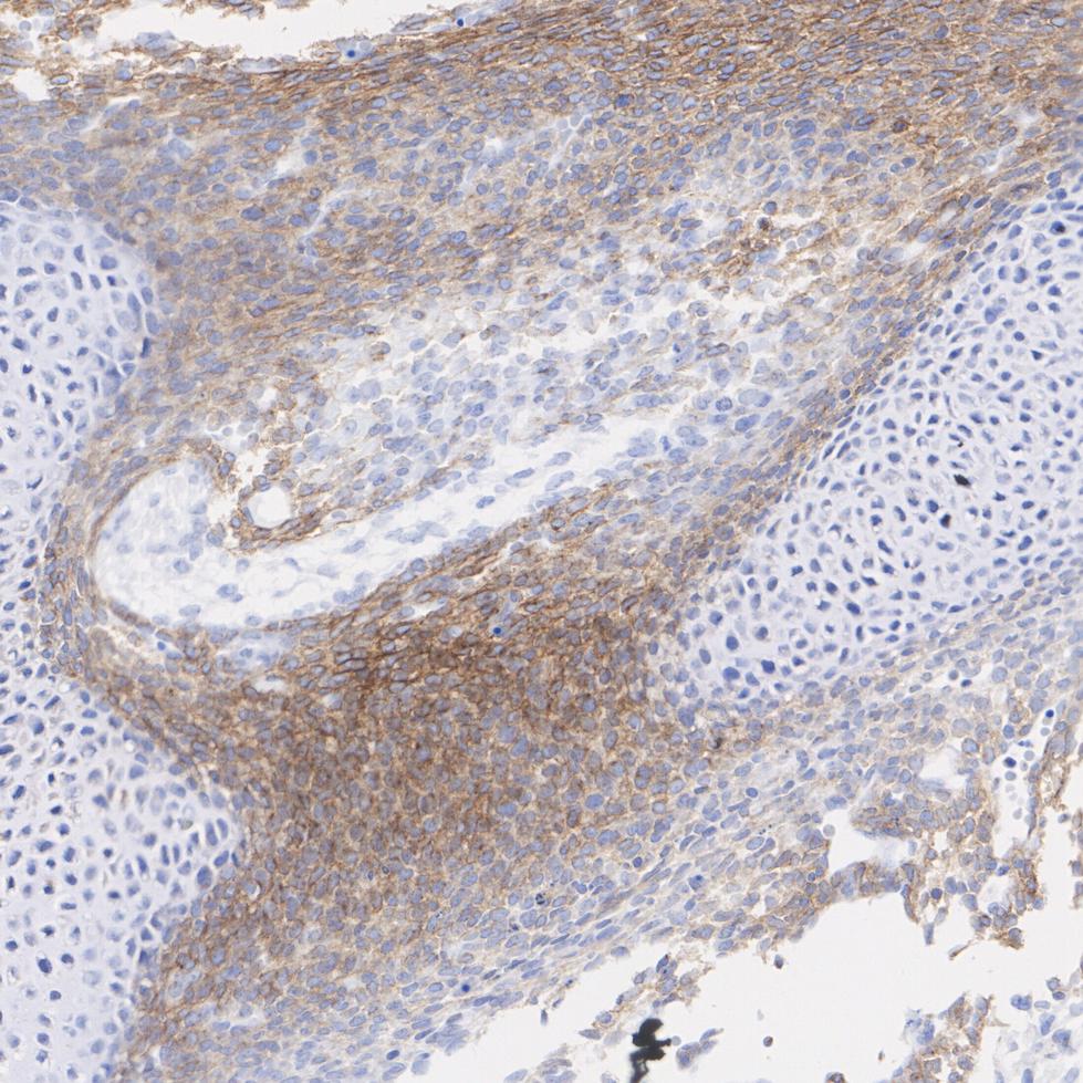 Immunohistochemical analysis of paraffin-embedded rat embryonic femur tissue with Rabbit anti-PDGFR alpha antibody (<a href="/products/ET1702-49" style="font-weight: bold;text-decoration: underline;">ET1702-49</a>) at 1/2,000 dilution.<br /><br />The section was pre-treated using heat mediated antigen retrieval with Tris-EDTA buffer (pH 9.0) for 20 minutes. The tissues were blocked in 1% BSA for 20 minutes at room temperature, washed with ddH<sub>2</sub>O and PBS, and then probed with the primary antibody (<a href="/products/ET1702-49" style="font-weight: bold;text-decoration: underline;">ET1702-49</a>) at 1/2,000 dilution for 1 hour at room temperature. The detection was performed using an HRP conjugated compact polymer system. DAB was used as the chromogen. Tissues were counterstained with hematoxylin and mounted with DPX.