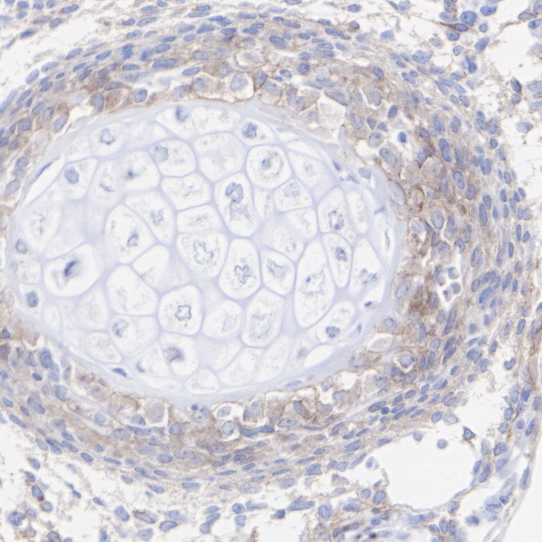 Immunohistochemical analysis of paraffin-embedded rat embryonic intervertebral disc tissue with Rabbit anti-PDGFR alpha antibody (<a href="/products/ET1702-49" style="font-weight: bold;text-decoration: underline;">ET1702-49</a>) at 1/500 dilution.<br /><br />The section was pre-treated using heat mediated antigen retrieval with Tris-EDTA buffer (pH 9.0) for 20 minutes. The tissues were blocked in 1% BSA for 20 minutes at room temperature, washed with ddH<sub>2</sub>O and PBS, and then probed with the primary antibody (<a href="/products/ET1702-49" style="font-weight: bold;text-decoration: underline;">ET1702-49</a>) at 1/500 dilution for 1 hour at room temperature. The detection was performed using an HRP conjugated compact polymer system. DAB was used as the chromogen. Tissues were counterstained with hematoxylin and mounted with DPX.