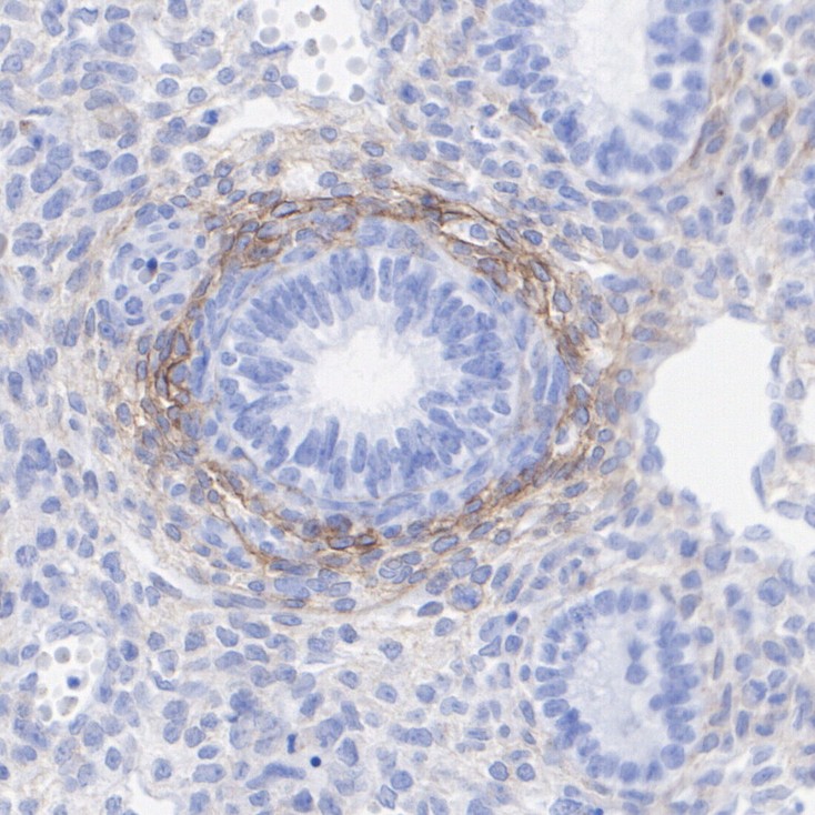 Immunohistochemical analysis of paraffin-embedded rat embryonic lung tissue with Rabbit anti-PDGFR alpha antibody (<a href="/products/ET1702-49" style="font-weight: bold;text-decoration: underline;">ET1702-49</a>) at 1/2,000 dilution.<br /><br />The section was pre-treated using heat mediated antigen retrieval with Tris-EDTA buffer (pH 9.0) for 20 minutes. The tissues were blocked in 1% BSA for 20 minutes at room temperature, washed with ddH<sub>2</sub>O and PBS, and then probed with the primary antibody (<a href="/products/ET1702-49" style="font-weight: bold;text-decoration: underline;">ET1702-49</a>) at 1/2,000 dilution for 1 hour at room temperature. The detection was performed using an HRP conjugated compact polymer system. DAB was used as the chromogen. Tissues were counterstained with hematoxylin and mounted with DPX.