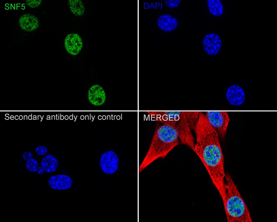 SNF5 Recombinant Rabbit monoclonal Antibody