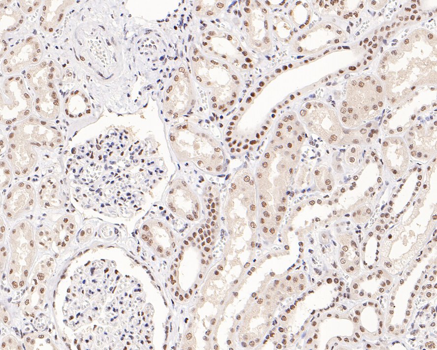 SNF5 Recombinant Rabbit monoclonal Antibody