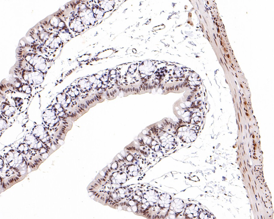 SNF5 Recombinant Rabbit monoclonal Antibody