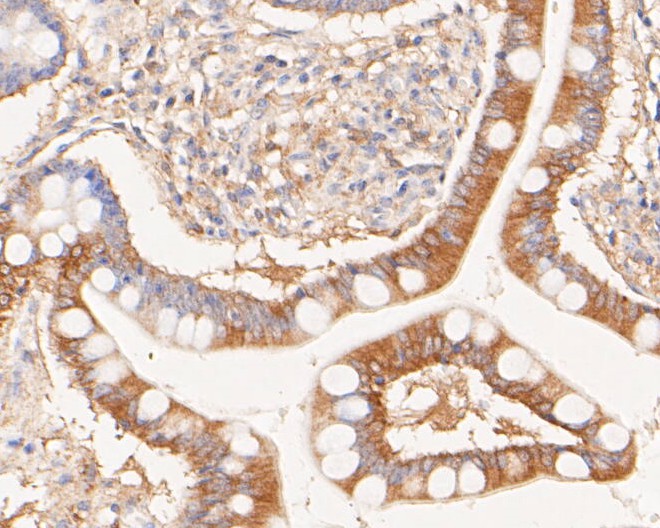 Immunohistochemical analysis of paraffin-embedded human small intestine tissue using anti-Phospho-Met (Y1349) antibody. The section was pre-treated using heat mediated antigen retrieval with Tris-EDTA buffer (pH 8.0-8.4) for 20 minutes.The tissues were blocked in 5% BSA for 30 minutes at room temperature, washed with ddH<sub>2</sub>O and PBS, and then probed with the primary antibody (<a href=