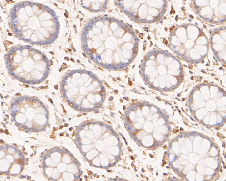 Immunohistochemical analysis of paraffin-embedded human rectum tissue using anti-Phospho-Met (Y1349) antibody. The section was pre-treated using heat mediated antigen retrieval with Tris-EDTA buffer (pH 8.0-8.4) for 20 minutes.The tissues were blocked in 5% BSA for 30 minutes at room temperature, washed with ddH<sub>2</sub>O and PBS, and then probed with the primary antibody (<a href=