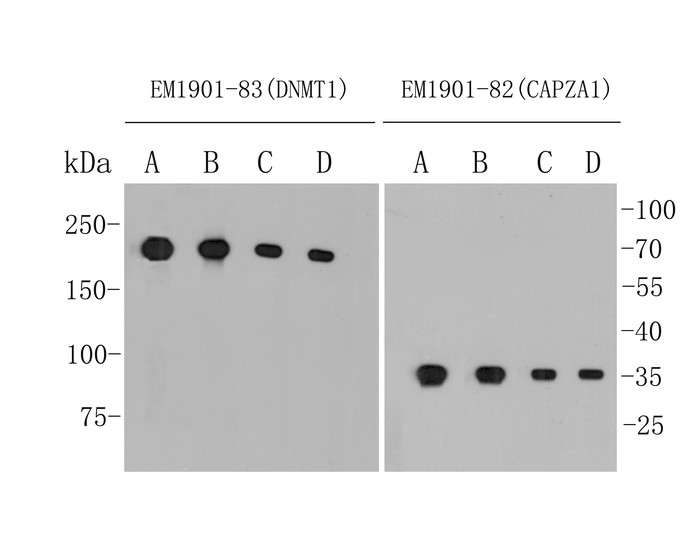 Western blot analysis of mouse anti-DNMT1 antibody (<a href=