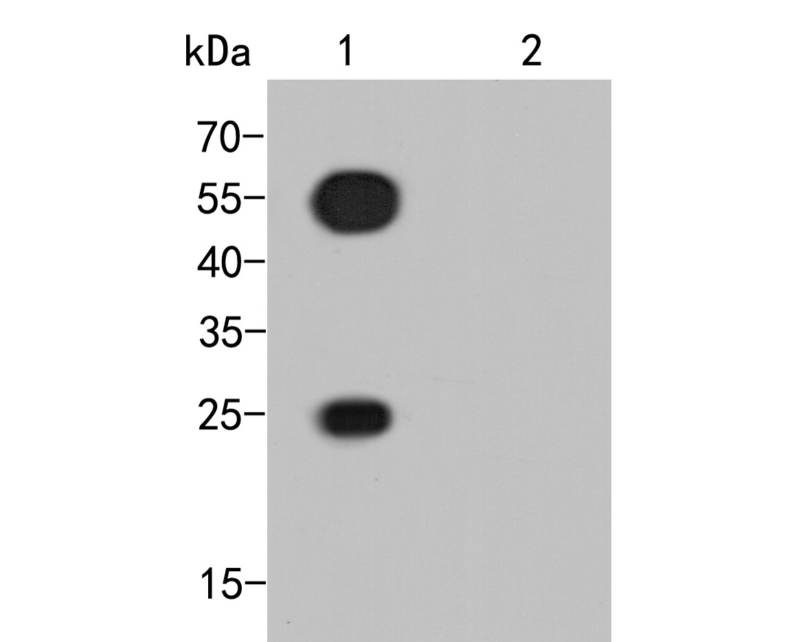 Proteins were transferred to a PVDF membrane and blocked with 5% BSA in PBS for 1 hour at room temperature. Rabbit anti-Guinea pig IgG-HRP (<a href=