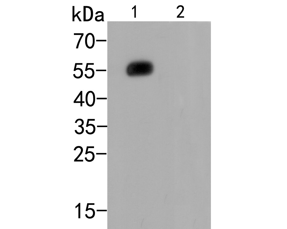 Proteins were transferred to a PVDF membrane and blocked with 5% BSA in PBS for 1 hour at room temperature. Rabbit anti-Human IgG-HRP (<a href=