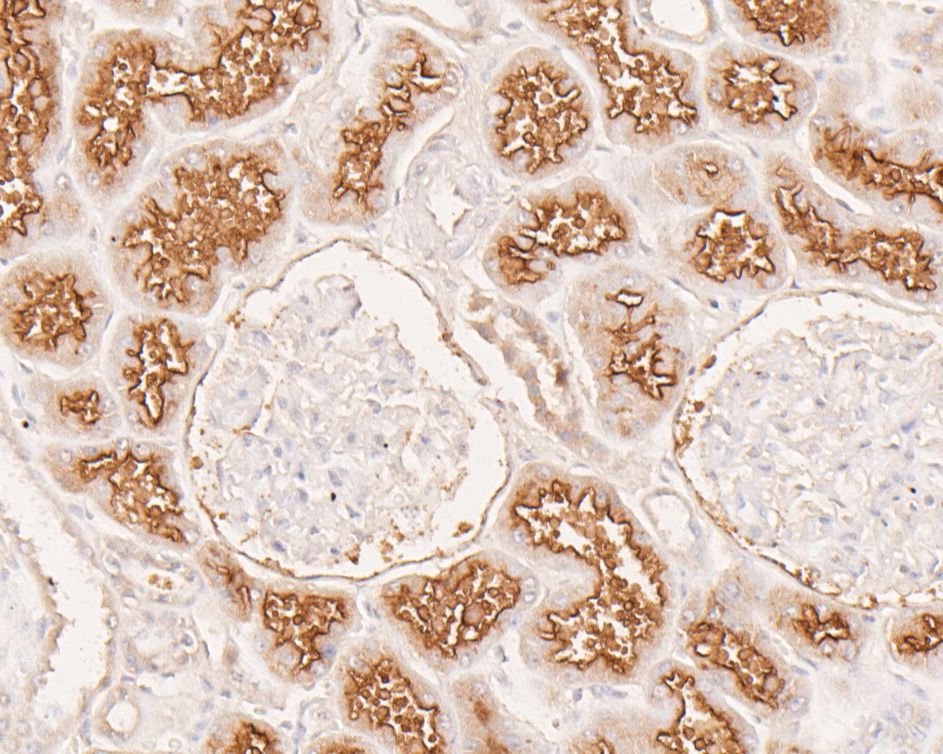 Immunohistochemical analysis of paraffin-embedded human Kidney tissue using rabbit anti-CD13 antibody.<br /><br />The section was pre-treated using heat mediated antigen retrieval with Tris-EDTA buffer (pH 8.0-8.4) for 20 minutes.The tissues were blocked in 5% BSA for 30 minutes at room temperature, washed with ddH<sub>2</sub>O and PBS, and then probed with the primary antibody (<a href=