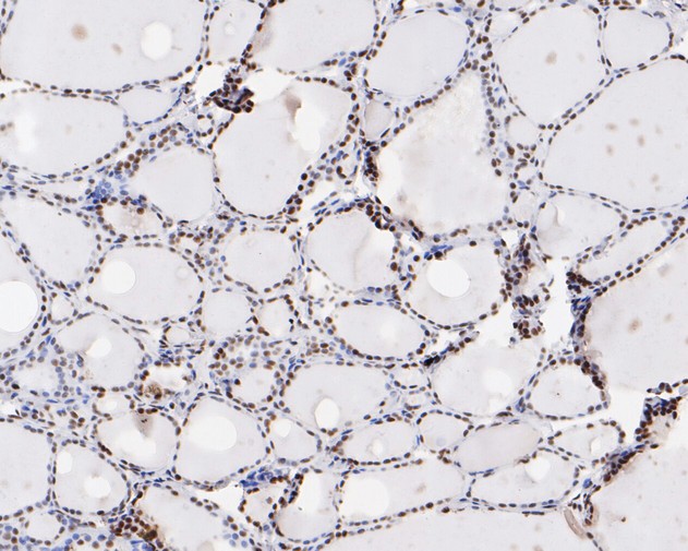 Immunohistochemical analysis of paraffin-embedded Human thyroid tissue using anti-NRF1 antibody. The section was pre-treated using heat mediated antigen retrieval with sodium citrate buffer (pH 6.0) for 20 mins. The detection was performed using an Goat anti-Rabbit IgG (H&L) - HRP (<a href=