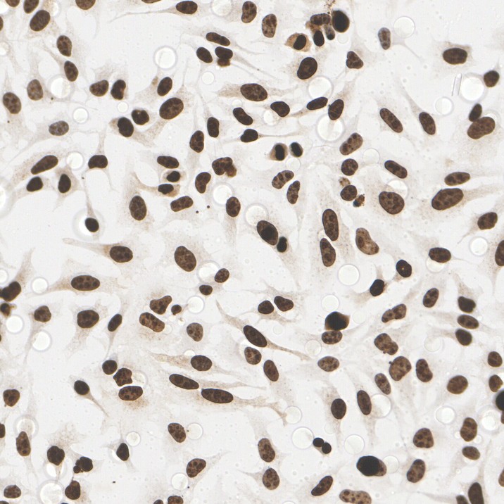 Analysis of HeLa cells labeling Ki67 with Rabbit anti-Ki67 antibody (<a href=