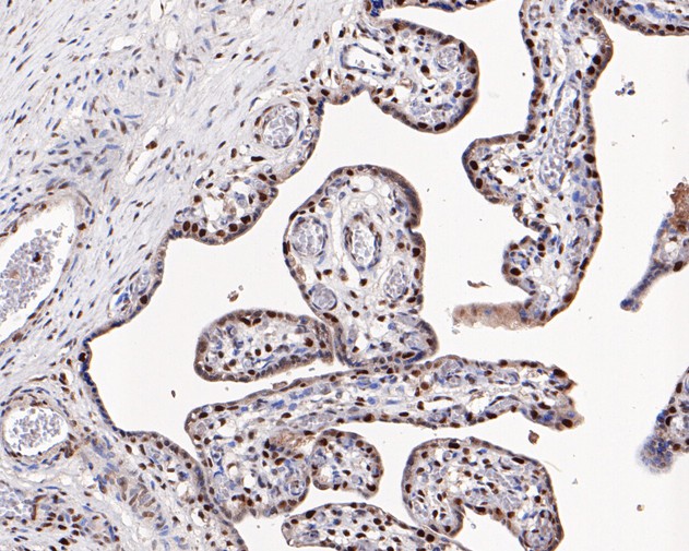 Immunohistochemical analysis of paraffin-embedded human placenta tissue using anti-MSH2 antibody. The section was pre-treated using heat mediated antigen retrieval with sodium citrate buffer (pH 6.0) for 20 mins. The detection was performed using an Goat anti-Mouse IgG (H&L) - HRP (<a href=