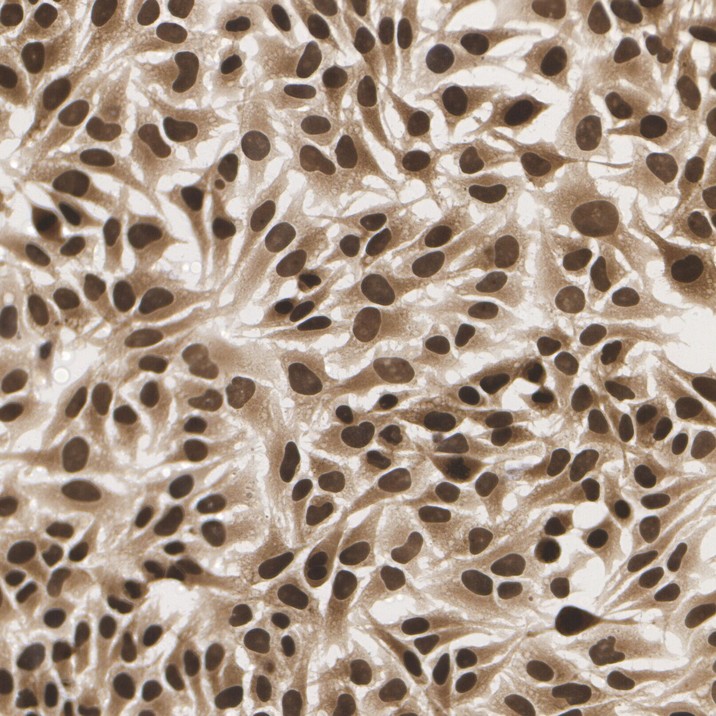 Analysis of HeLa cells labeling p16 with Mouse anti-p16 antibody (<a href=