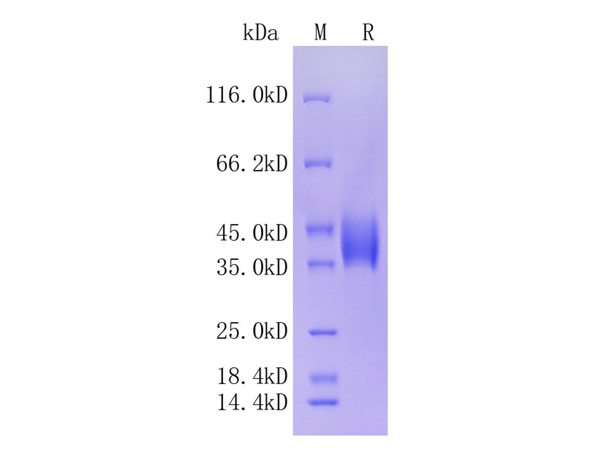 Mouse Complement Factor D; C-His Tag