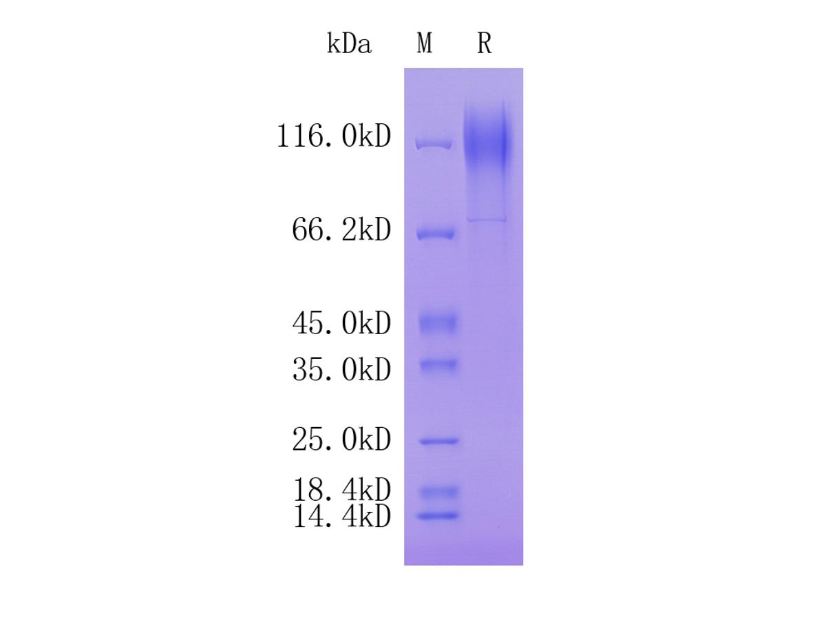 Human Coagulation factor VIII; Tag Free