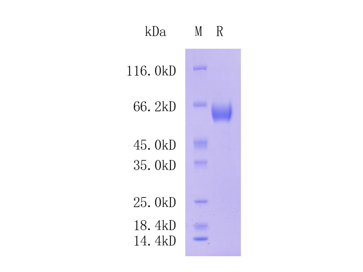 Human ROR1; Tag Free