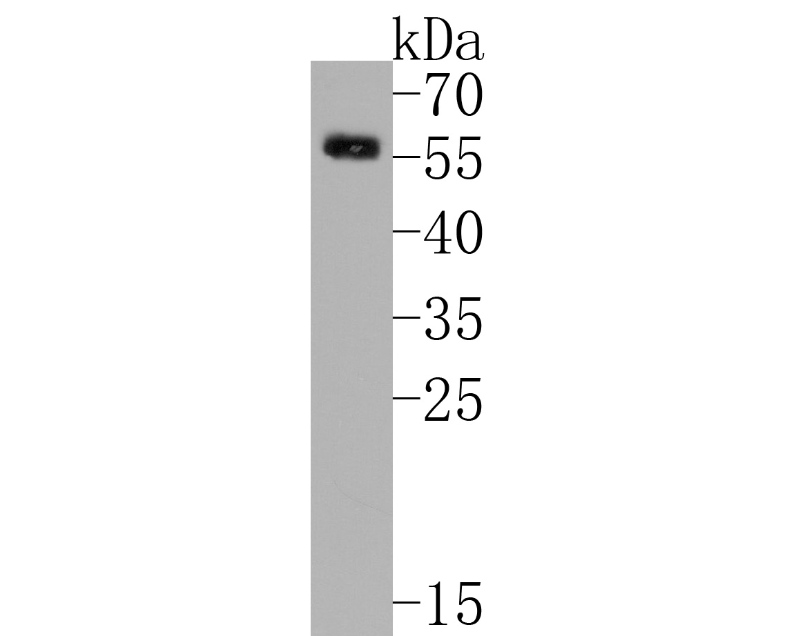 glp 1 room temperature GLP-1 Injection Storage: Refrigeration Requirements & Guidelines PlexusDx GLP-1R Rabbit Polyclonal Antibody
