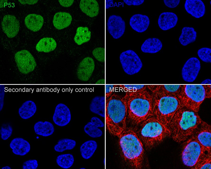 Immunocytochemistry analysis of A431 cells labeling p53 with Mouse anti-p53 antibody (<a href=