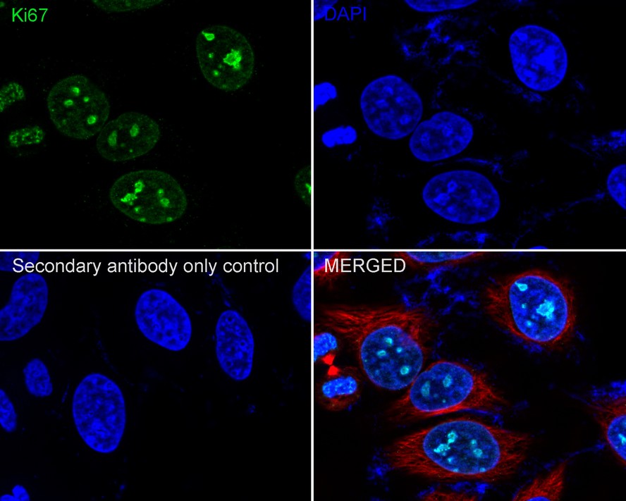 Fluorescence multiplex immunohistochemical analysis of mouse lung (Formalin/PFA-fixed paraffin-embedded sections). Panel A: the merged image of anti-TTF1 (<a href="/products/HA720067" style="font-weight: bold;text-decoration: underline;">HA720067</a>, Red), anti-RAGE (<a href="/products/ET1702-27" style="font-weight: bold;text-decoration: underline;">ET1702-27</a>, Green), anti-aSMA (<a href="/products/ET1607-53" style="font-weight: bold;text-decoration: underline;">ET1607-53</a>, Cyan) and anti-Ki67 (<a href="/products/HA721115" style="font-weight: bold;text-decoration: underline;">HA721115</a>, Yellow) on mouse lung. HRP Conjugated UltraPolymer Goat Polyclonal Antibody HA1119/HA1120 was used as a secondary antibody. The immunostaining was performed with the Sequential Immuno-staining Kit (IRISKit™MH010101, www.luminiris.cn). The section was incubated in four rounds of staining: in the order of <a href="/products/HA720067" style="font-weight: bold;text-decoration: underline;">HA720067</a> (1/4,000 dilution), <a href="/products/ET1702-27" style="font-weight: bold;text-decoration: underline;">ET1702-27</a> (1/3,000 dilution), <a href="/products/ET1607-53" style="font-weight: bold;text-decoration: underline;">ET1607-53</a> (1/10,000 dilution) and <a href="/products/HA721115" style="font-weight: bold;text-decoration: underline;">HA721115</a> (1/3,000 dilution) for 20 mins at room temperature. Each round was followed by a separate fluorescent tyramide signal amplification system. Heat mediated antigen retrieval with Tris-EDTA buffer (pH 9.0) for 30 mins at 95℃. DAPI (blue) was used as a nuclear counter stain. Image acquisition was performed with Olympus VS200 Slide Scanner.